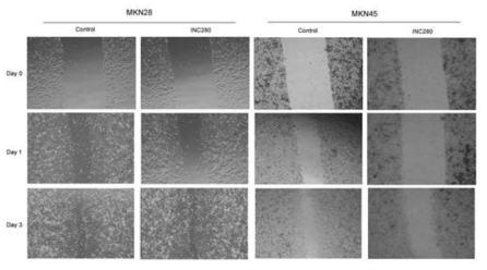 Wound-healing assay was used to assess the effect of INC280 on the migration ability of MKN28 and MKN45 cells. INC280-treated MKN45 cells showed suppressed migration ability compared with INC280-treated MKN28 cell lines