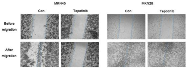 A wound-healing assay was used to assess the effect of tepotinib on the migration abilities of MKN28 and MKN45 cells. Tepotinib-treated MKN45 cells showed suppressed migration ability compared with tepotinib-treated MKN28 cells. Con, non-treated control cell lines