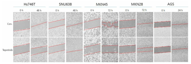 A wound-healing assay was used to assess the effect of tepotinib on the migration abilities of gastric cancer cells