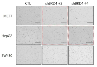 BRD4 발현 억제에 따른 세포 외형 변화 관찰