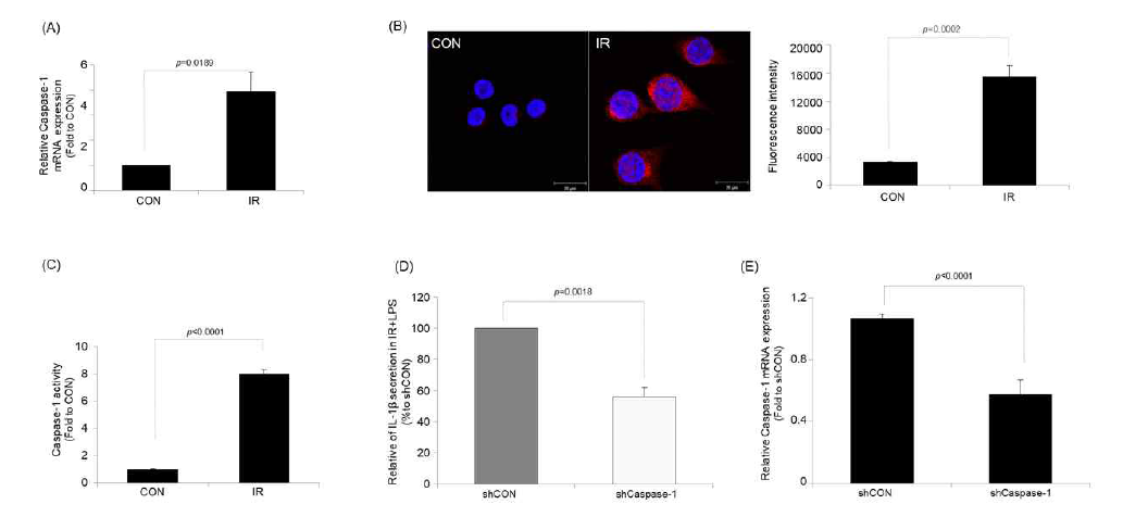 대식세포에서 방사선에 의해 활성화되는 Caspase-1 발현 증가 및 shRNA를 통한 IL-1beta 발현간의 상관관계 연구
