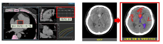 닥터앤서를 통한 임상 실증 지원 사례 (심, 뇌혈관)