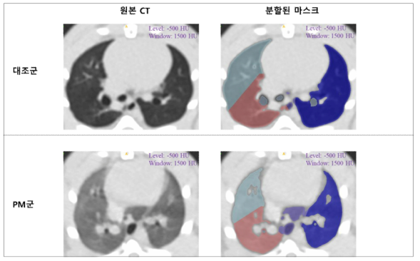 26주 차 대조군과 미세먼지 군 원본 CT 및 분할된 마스크의 비교