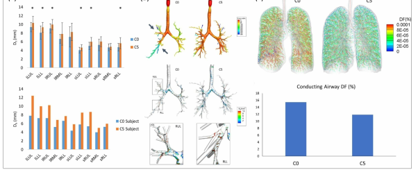 군집 C0와 C5 대표 피검자에서의 (a) 기도 사이즈 비교, (b) 3D CFD 시뮬레이션을 통한 기도 내 공기 압력 강하(위) 및 입자 침착(아래) 비교, 및 (c) 1D CFD 시뮬레이션을 통한 폐에서의 입자 deposition fraction 비교