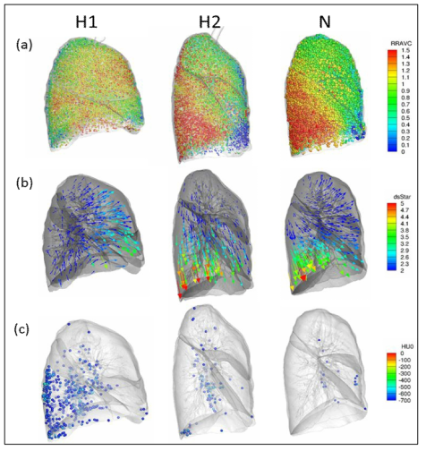 정상소견 가습기살균제 노출군 성인 중 영상기반 변수 특징을 잘 반영하는 피검자(H1)와 비노출 정상인에 가까운 변숫값들을 보인 피검자(H2), 및 비노출 정상인(N)에서 (a) 지역적 폐 환기성(RRAVC), (b) 무차원화된 displacement vector (s*), 및 (c) HAA 분포도 예시