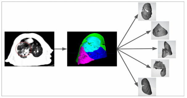 가습기살균제에 노출된 3D Rat Lung Segmentation