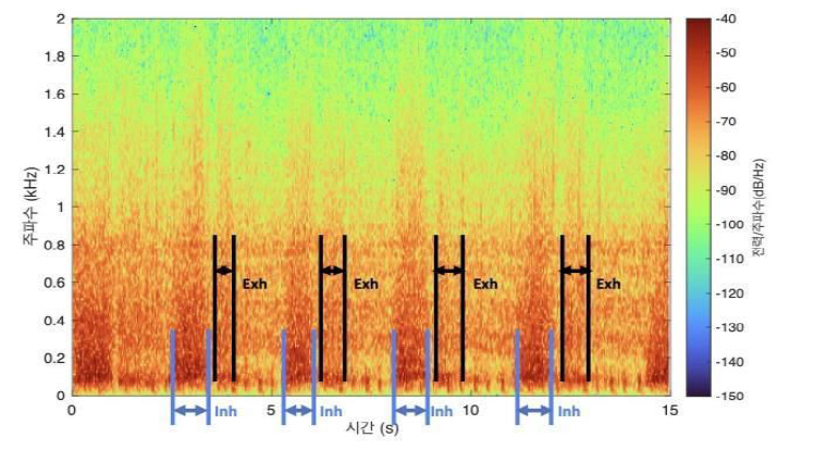 정상적인 호흡음의 Spectrogram