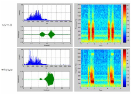 Microphone chip 종류에 따른 생체신호 분석 #1. SPW0690LM4H-1