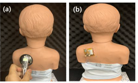 Lung Sim. (a) with 리트만, (b) LSP