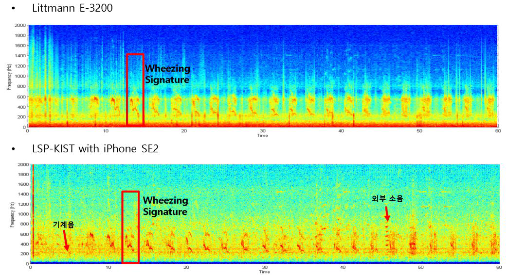 환자 동시 청음구간#1(우측) 분석결과 (Spectrogram)