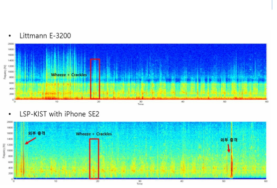 COPD 환자 동시 청음구간#2(좌측) 분석결과 (Spectrogram)