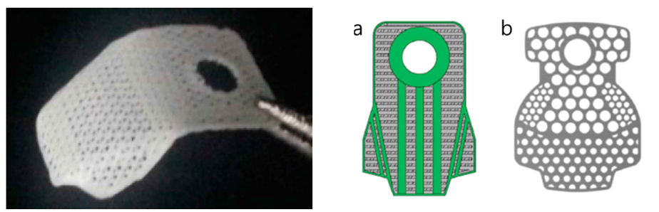 3D 프린팅으로 제작된 PCL/PLGA/TCP 치주조직재생유도재의 예(왼쪽 – 실제 제작 샘플; 오른쪽 – 차폐막 디자인[Shim 등(2015) Polymer 7(10):2061-2077]