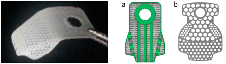 3D 프린팅으로 제작된 PCL/PLGA/TCP 치주조직재생유도재의 예(왼쪽 – 실제 제작 샘플; 오른쪽 – 차폐막 디자인[Shim 등(2015) Polymer 7(10):2061-2077]