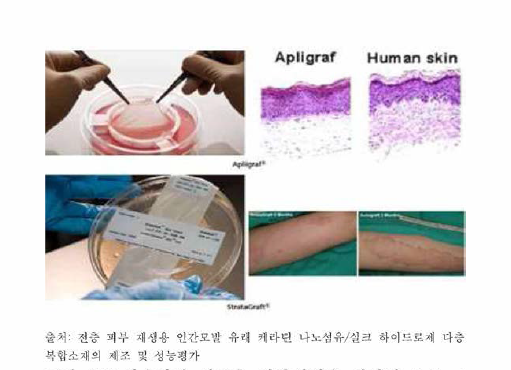 상용화된 이중증 피부재생용 지지체 (Apligraf ⓇStrataGraftⓇ)