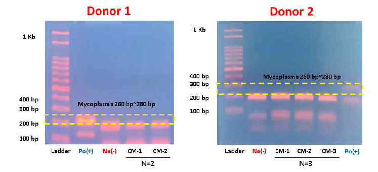 다양한 공여자 유래 줄기세포 배양액 내 mycoplasma test 평가