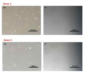 광학현미경을 이용한 다양한 공여자 유래 줄기세포 형태 및 크기평가