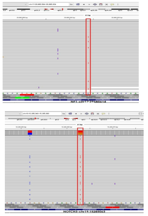NF1, NOTCH3 유전자 변이