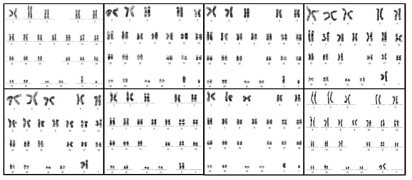 염색체 분석 결과 그림