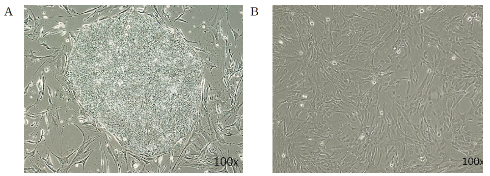 Sendai virus (SeV) based reprogramming을 이용한 미분화 iPS 세포(A) 및 iPS 유래 iMSC 세포(B)의 세포 형태