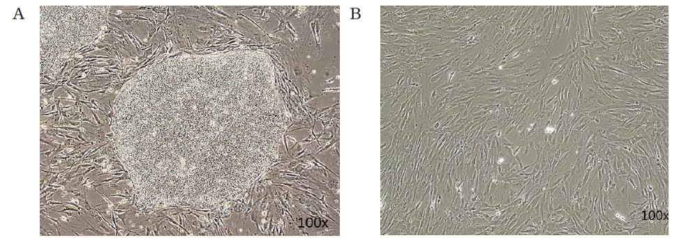 Episomal vector (Epi) reprogramming을 이용한 미분화 iPS 세포(A) 및 iPS유래 iMSC 세포(B)의 세포 형태