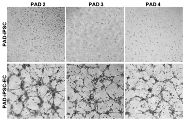 임상등급 PAD-hiPSC-EC의 형관형성능력 평가