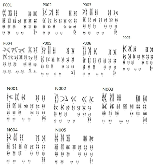 형질전환된 유도만능줄기세포의 염색체 이상 여부 검사