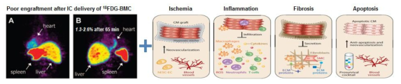 허혈성 심장질환에서 기존 줄기세포 치료의 문제점
