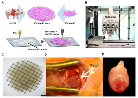 SDF1α-eMSC 탑재 3D hdECM 심장패치 제작