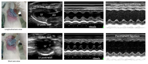 심장초음파를 이용한 심기능 평가기준 수립