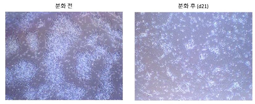 iDP 분화 전 및 분화 후 21일째의 광학현미경 사진
