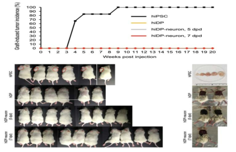 피하 이식을 통한 iDP 및 iDP-DN의 종양원성 평가. hiPSC: 양성 대조군