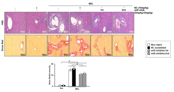 target microRNA 이식 후 만성 간경변증 동물 간 조직에서의 항섬유화 분석