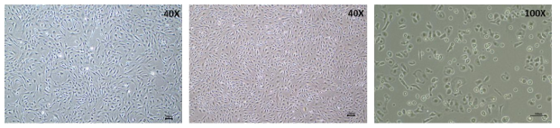 각 세포 타입별 형태 (좌; fibroblast cell, 중앙; endotherial cell, 우; hiPS-cardiomyocytes)