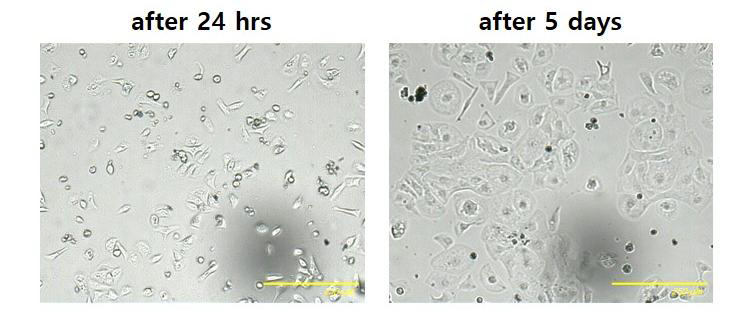 심근세포 파종 1일차 및 5일차 형태 확인