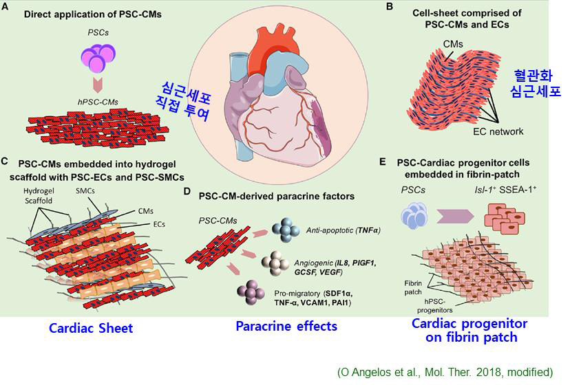 줄기세포유래 심근세포치료제 연구 현황