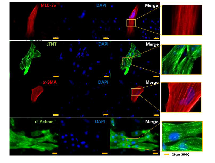Xeno free로 분화된 심근세포의 지표 단백질 발현 확인