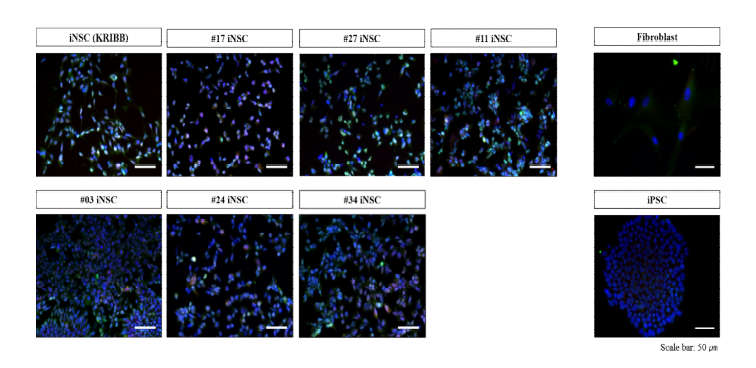 분화 유도된 신경줄기세포의 단백질 발현 양상 (Pax-6, SOX-1)