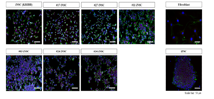 분화 유도된 신경줄기세포의 단백질 발현 양상 (SOX-2, Nestin)