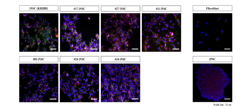 분화 유도된 신경줄기세포의 단백질 발현 양상 (BLBP, N-cadherin)
