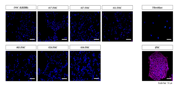 분화 유도된 신경줄기세포의 단백질 발현 양상 (OCT4)