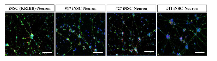 분화 유도된 신경세포의 Tuj1, MAP2 발현