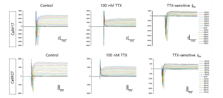 신경세포에서 기록된 TTX-sensitive 내향성 Na+ 전류