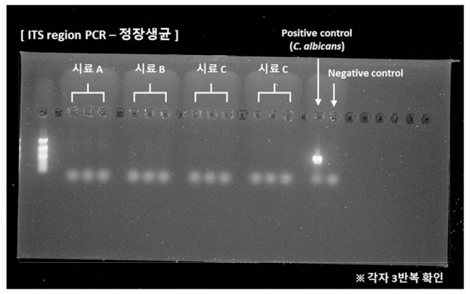 ITS region PCR을 이용한 진균류 오염 검출 결과
