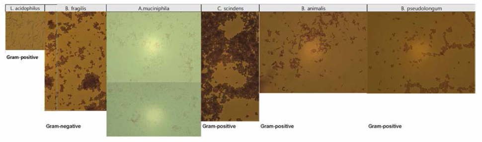 혐기성 균주별 그람염색 결과