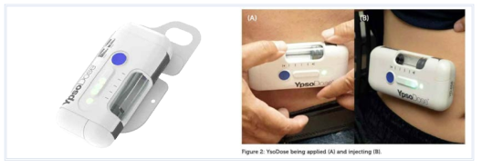 웨어러블 자동주사 시스템 사례 (YpsoDose)