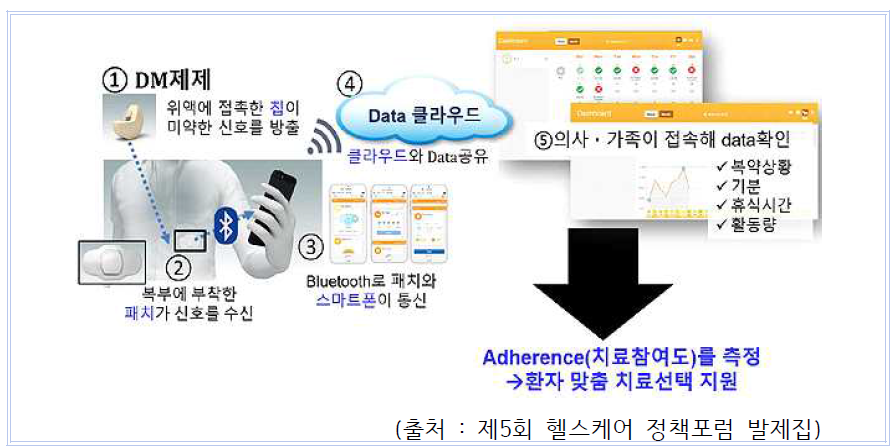 센서가 내장된 디지털 신약