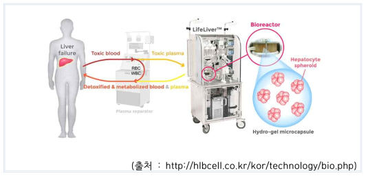 체외 순환형 바이오 인공간 (HLB 라이프사이언스社)