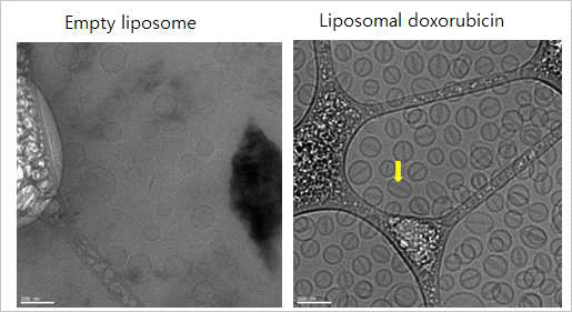 빈 리포좀과 약물 봉입 리포좀의 cryoTEM 이미지. 스케일바는 100nm에 해당하며 노란 화살표는 doxorubicin 나노크리스탈로 추정됨