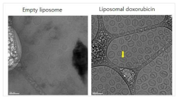 빈 리포좀과 약물 봉입 리포좀의 대표 CryoTEM 이미지. 스케일바는 100 nm에 해당. 노란 화살표는 doxorubicin 나노크리스탈임