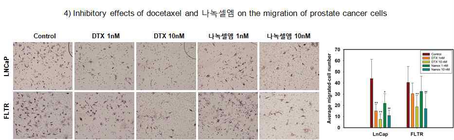 도세탁셀 및 나녹셀의 LNCaP 전립선암세포 및 FLTR AR 길항제 저항성 암세포에서 세포이동능에 미치는 효과